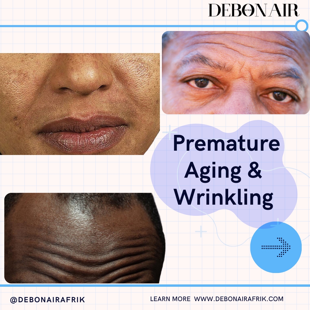 Wrinkle prevention for Black Skin